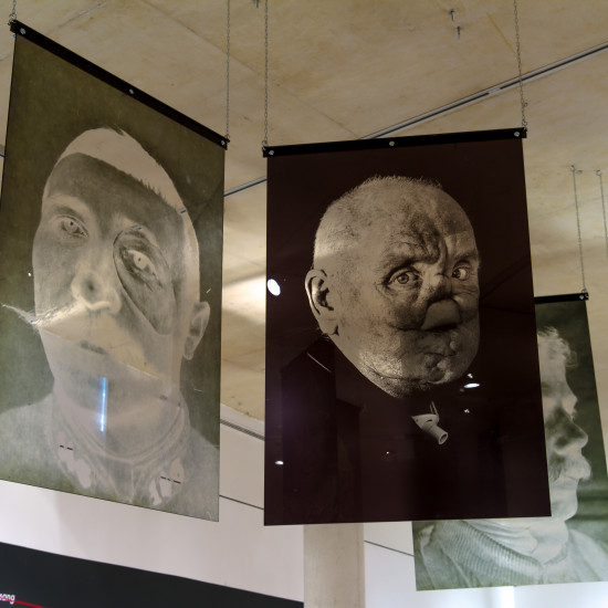 image du projet Face à face (regards sur la défiguration)